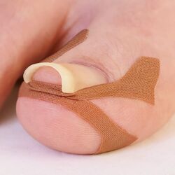 プラスウォーク 巻き爪ダブルテープ